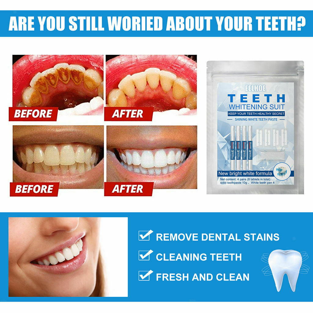 Set of Teeth Stickers Teeth Whitening Pen Teether Removal of tooth stains