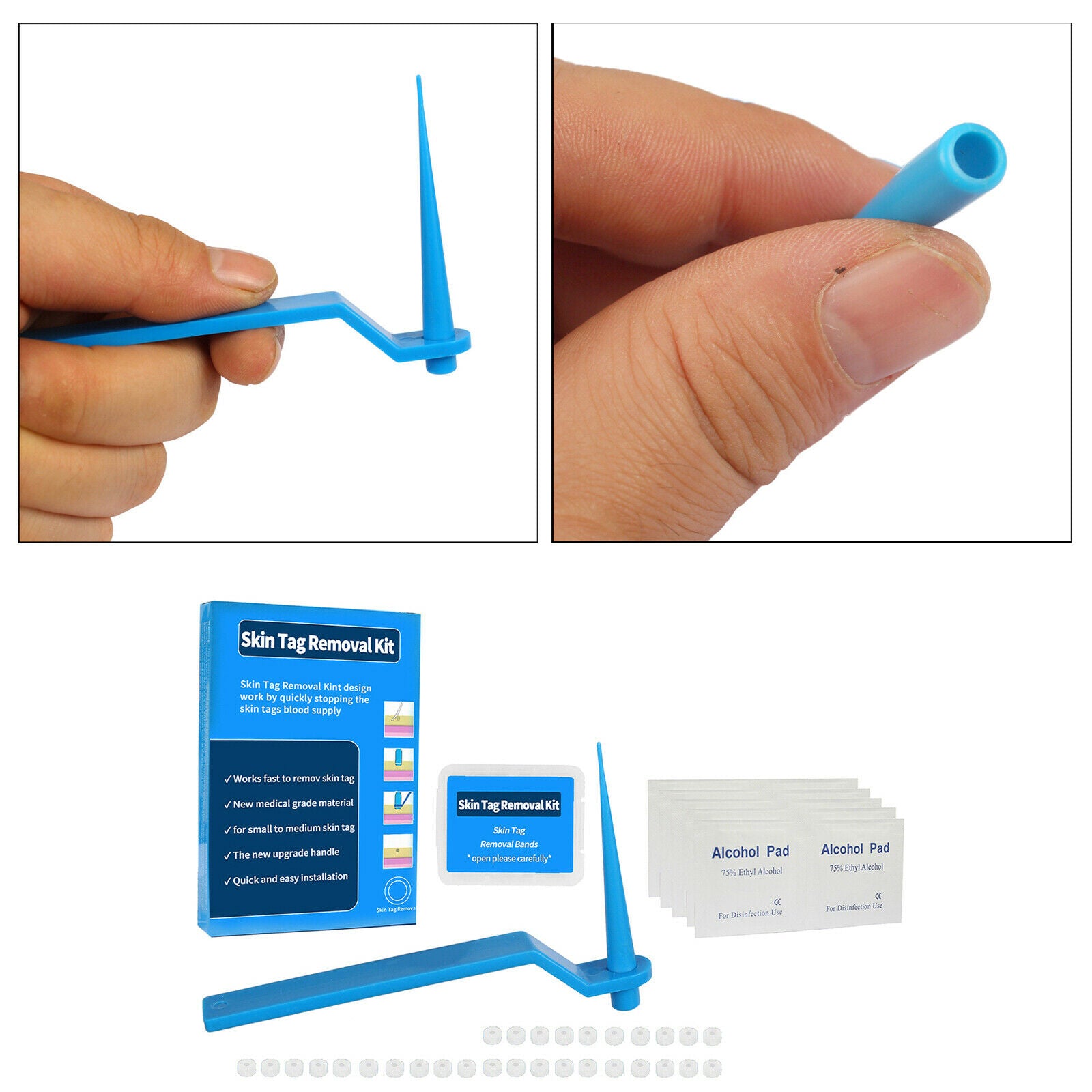 Beauty Home Non Toxic Skin Tag Removal Kit Tag Cure Remover Device 30x Bands