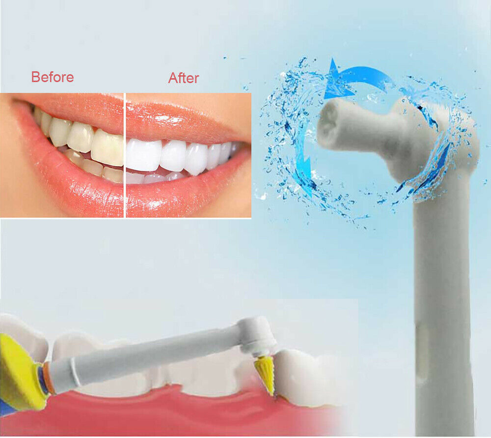 Dental Teeth Whitening Polisher Replacement Heads for Electric Toothbrush Oral-B