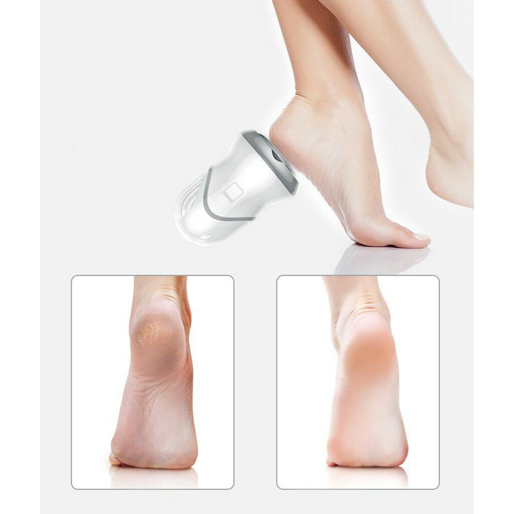 Electric Pedicure Foot File Callus Remover Portable