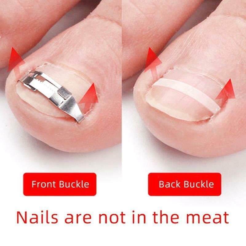 Toenail Fixer Foot Care Tool Paronychia File Patch Corrector Tool Toenail Care