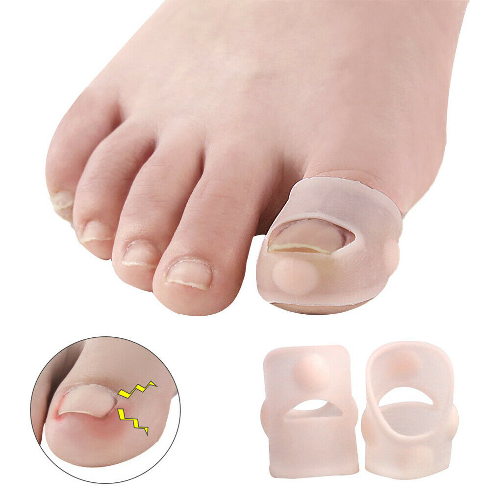 5 Pairs Silicone Ingrown Toenail Corrector Pedicure Tools for Men Women
