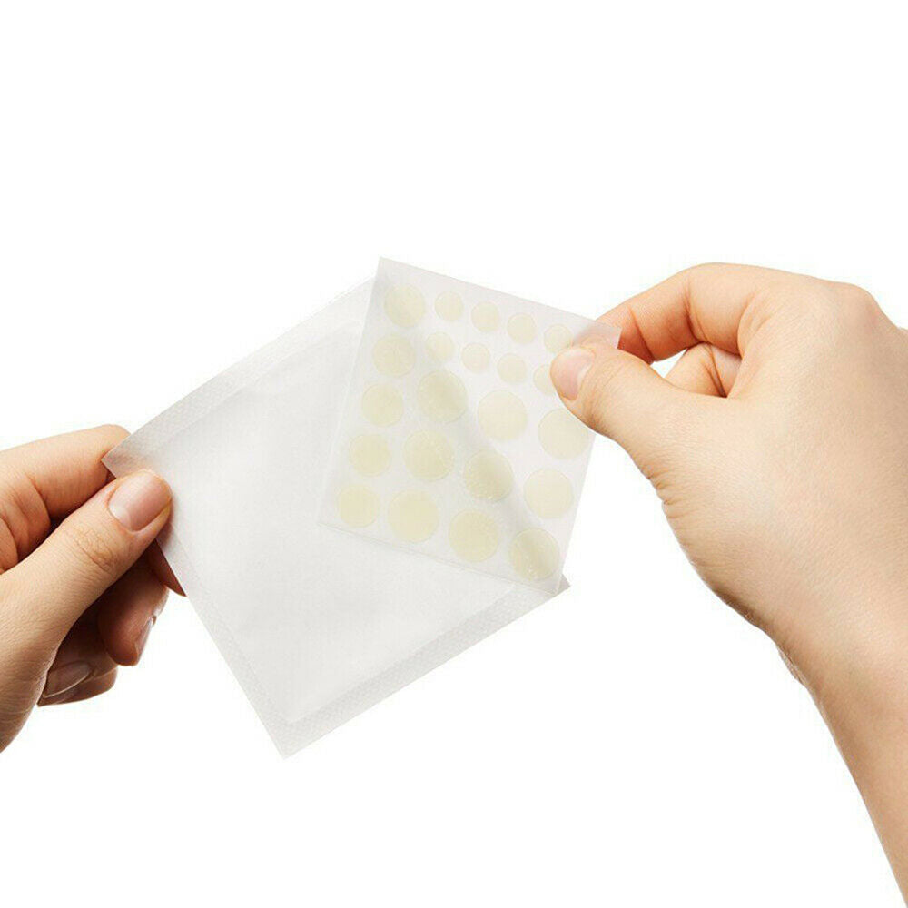 36 Patches Anti Acne Pimple Patch Face Skin Spot Scar Care Treatment Stickers ..