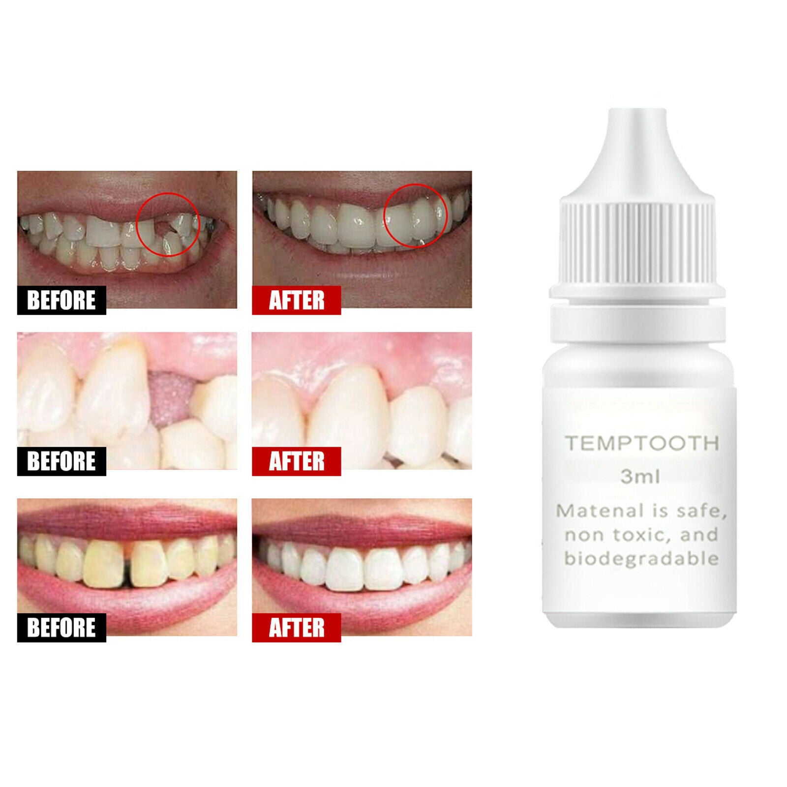 3ml Moldable Thermal Fitting Beads Temporary Teeth Repair Kit Thermal Beads