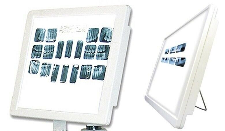 Dental TPC Super Thin LED X-Ray Viewer Counter Top Wall or Unit Mounted