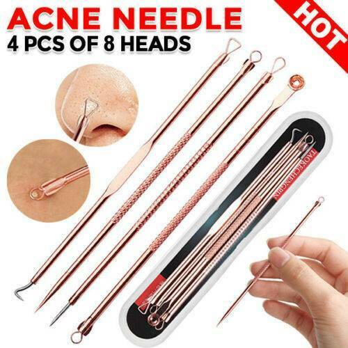 Blackhead Remover Tool â€“ Pimple Popper Whitehead Removal Blemish Pore Extractor