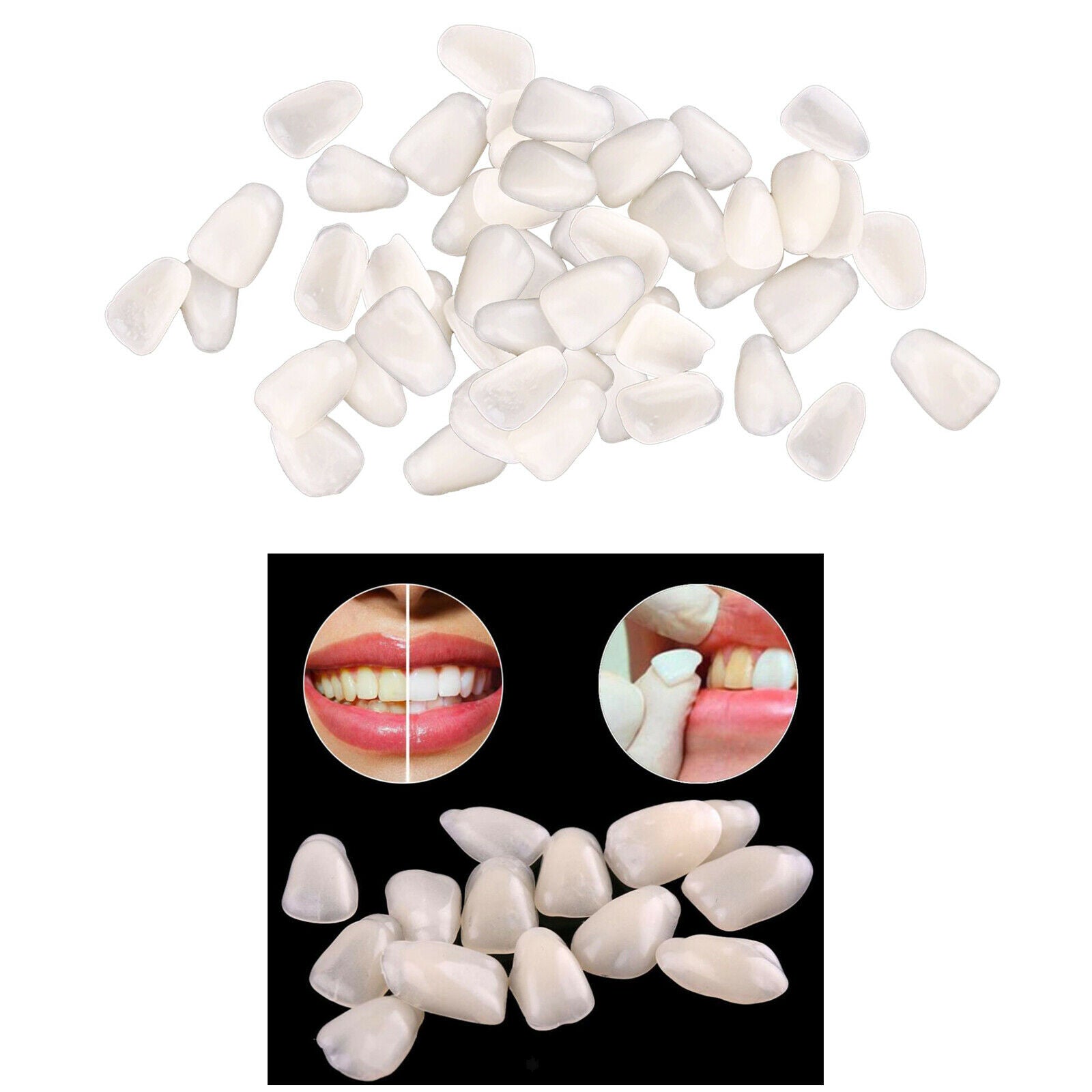 Teeth Temporary Crown Veneers Anterior Front Kit Dentist Products Beige