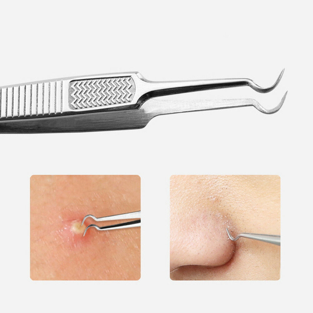 Facial extractor blackhead acne blemish remover tweezers bend curved need.l8