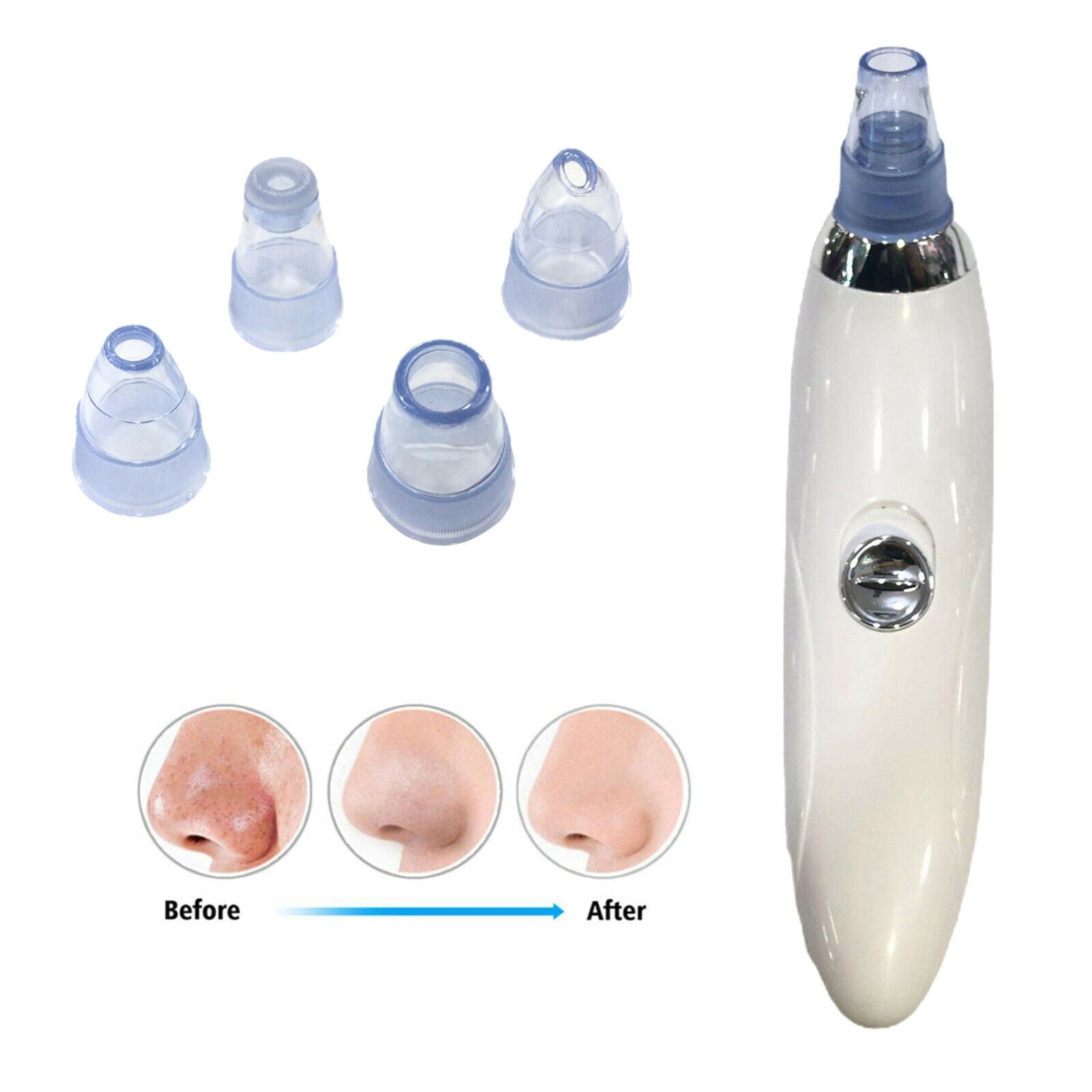 Blackhead Remover Vacuum Electric Facial Pore Cleaner Acne Comedone Extractor