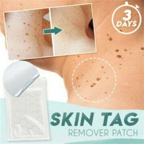 36 Patches Anti Acne Pimple Patch Face Skin Spot Scar Care Treatment Stickers ..