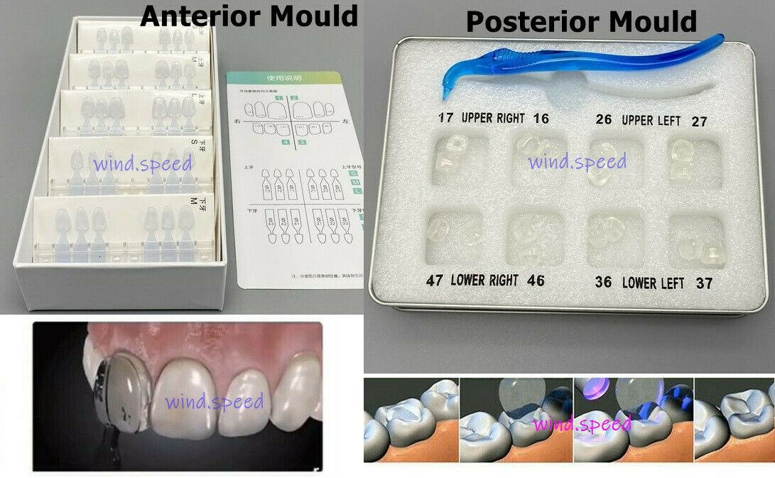 Dental Restoration Filling Tools Mould Aesthetic Printing Posterior Front Teeth