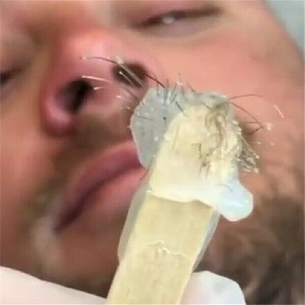 Nose Ear Hair Removal Wax Kit Set Sticks Easy Mens Nasal Waxing Strip Remover^UK