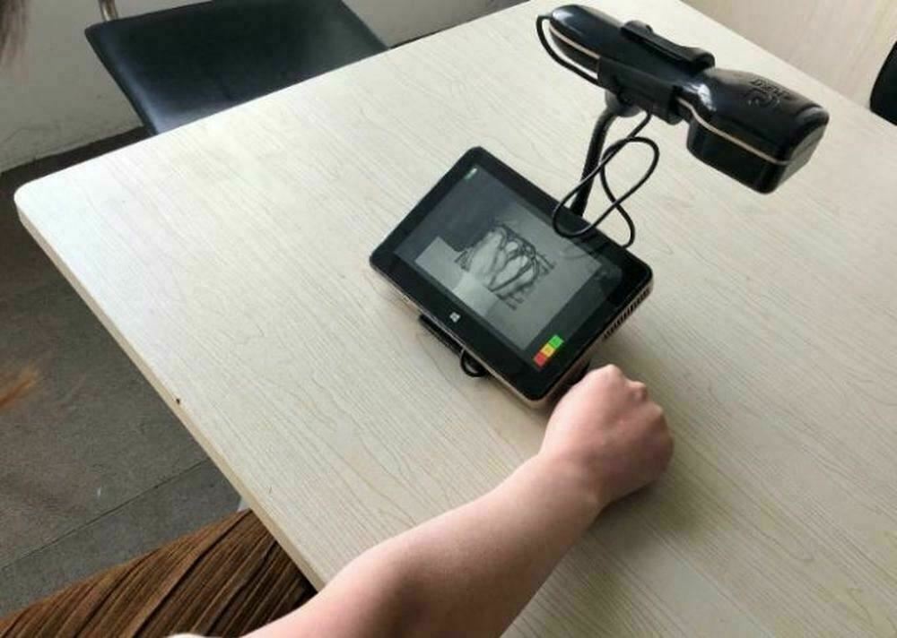 Vein Viewer Finder Locator LCD Touch Screen Imaging Illumination Visualization