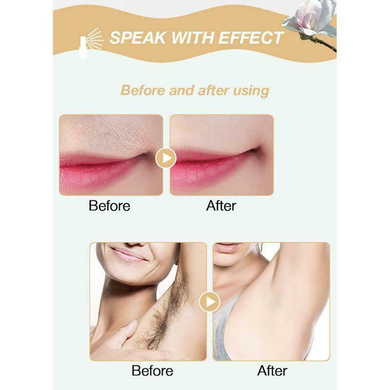 20ml Hair Growth Inhibitor Spray Body Natural Ingredients Hair Removal Essence