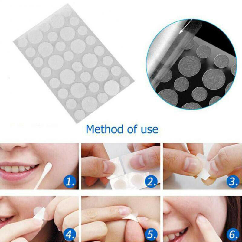 36Pcs Skin Tag & Acne Patch Hydrocolloid Acne and Skin Tag Remover Patch.l8
