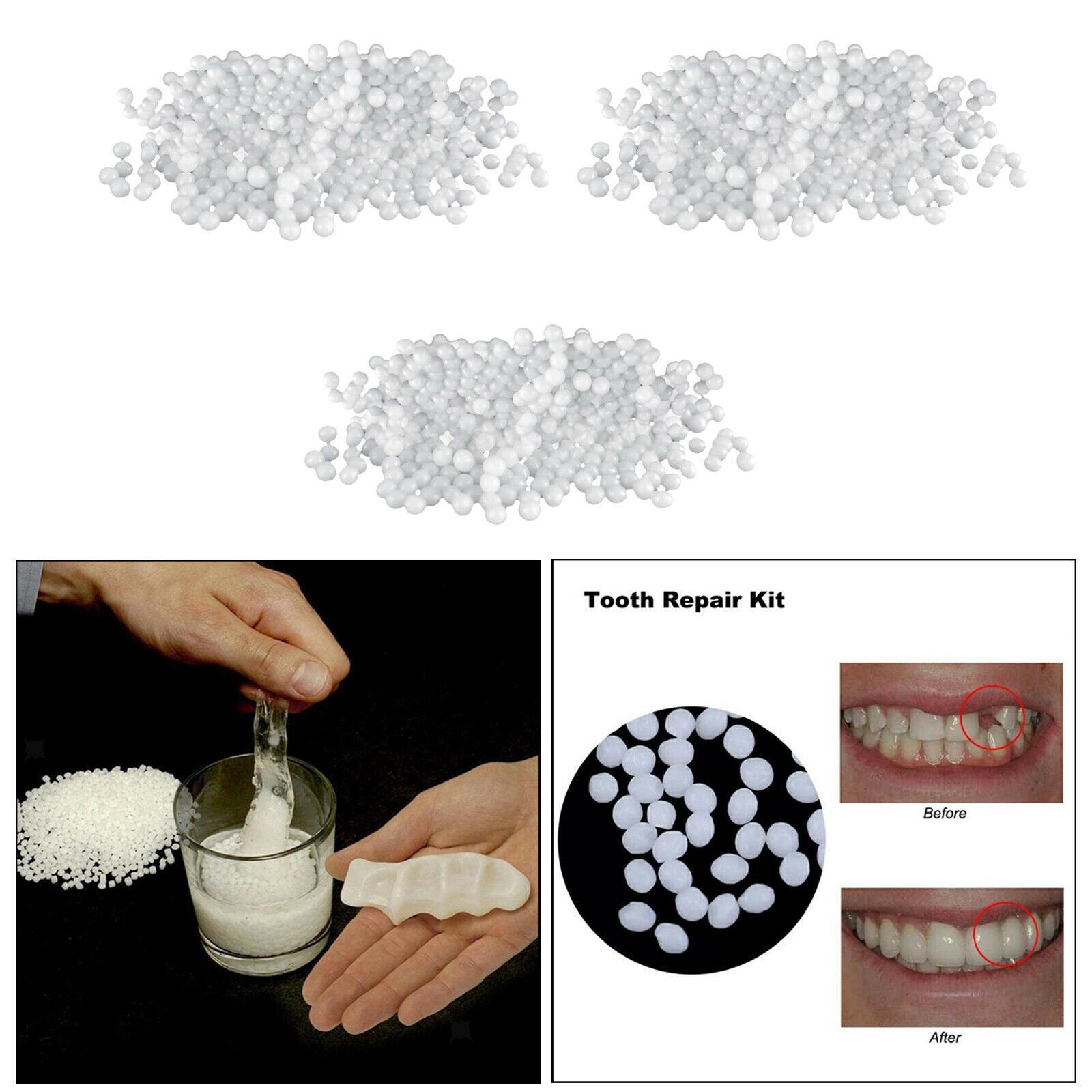 Dental Thermal Fitting Beads 100g Temporary Tooth Repair Thermal Beads