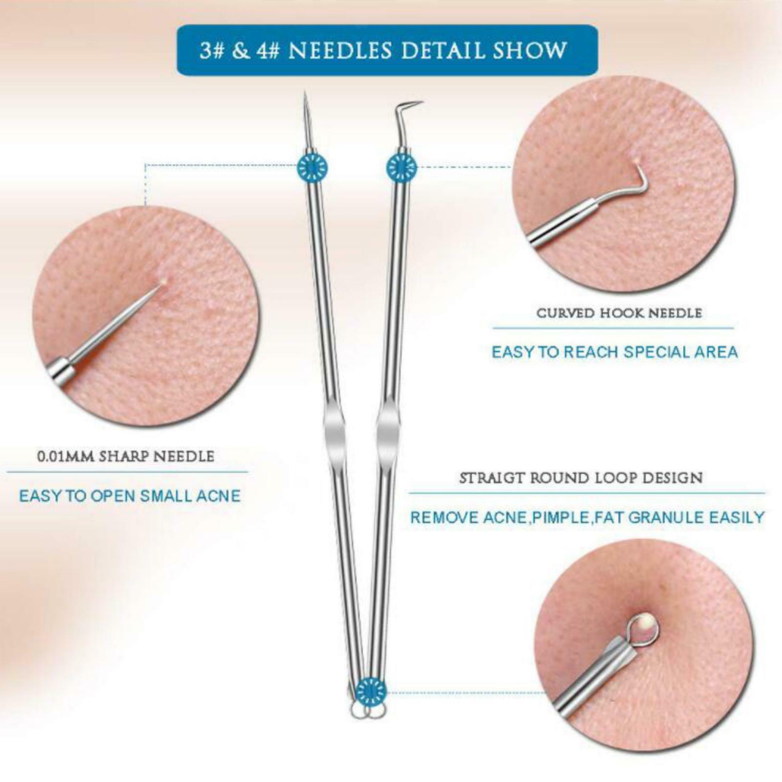 Whitehead Comedone Blemish Remover Extraction With Box for Nose Facial Pore
