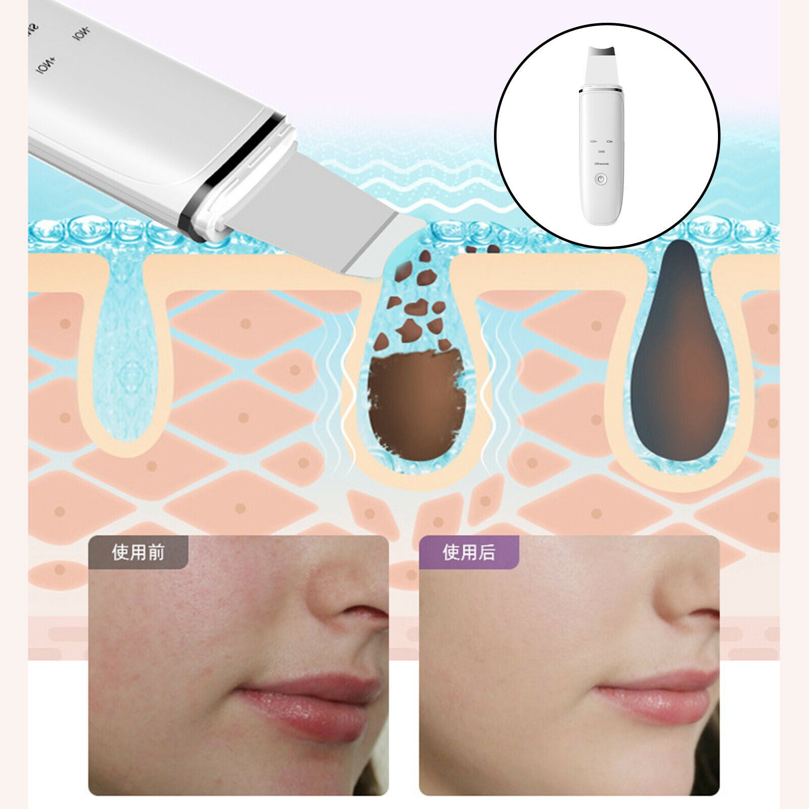 Ultrasonic Skin Scrubber Cleaner Remover 500mAh Tools for Deep Cleaning ABS