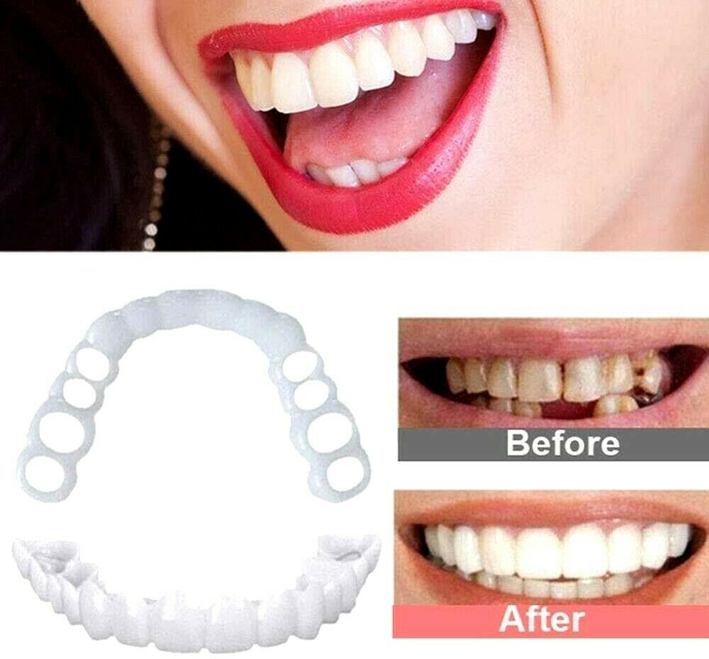 Magic Teeth Brace Temporary Smile Comfort Fit Cosmetic Denture Teeth Dent