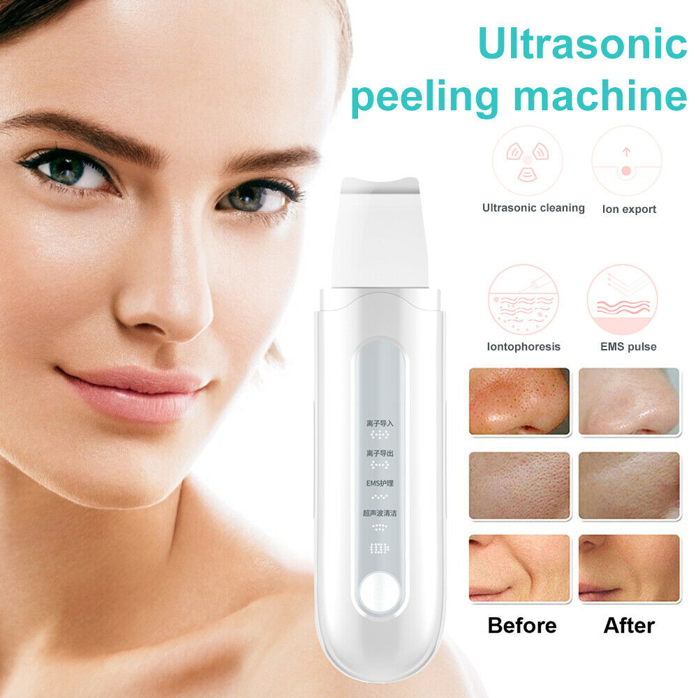 Ion Ultrasonic Skin Scrubber Blackhead Peeling Remover Facial Pore Deep Cleaning
