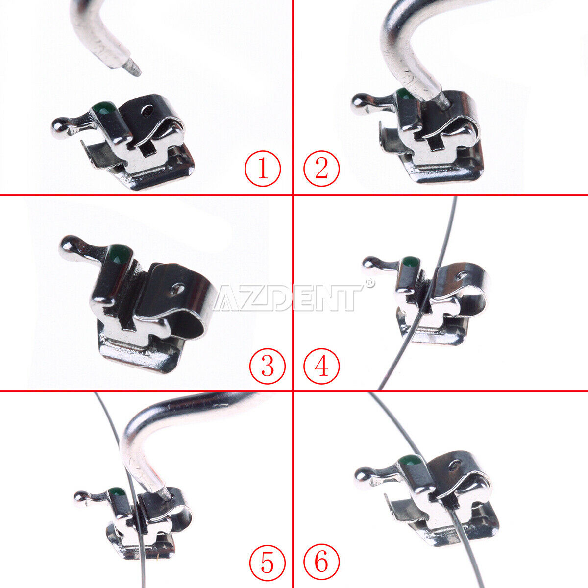 Dental Ortho Active Self-ligating Brackets Mini MBT 022 Hooks 3 4 5 Buccal Tube