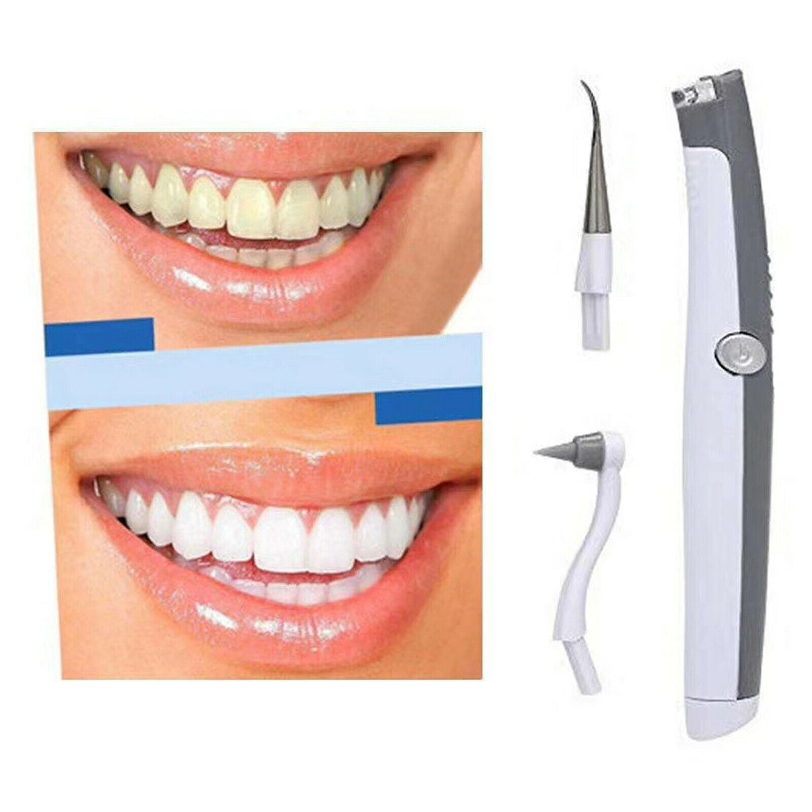 Portable Oral Clean Electric Sonic Scaler Cleaning Tooth Cleaner Machine
