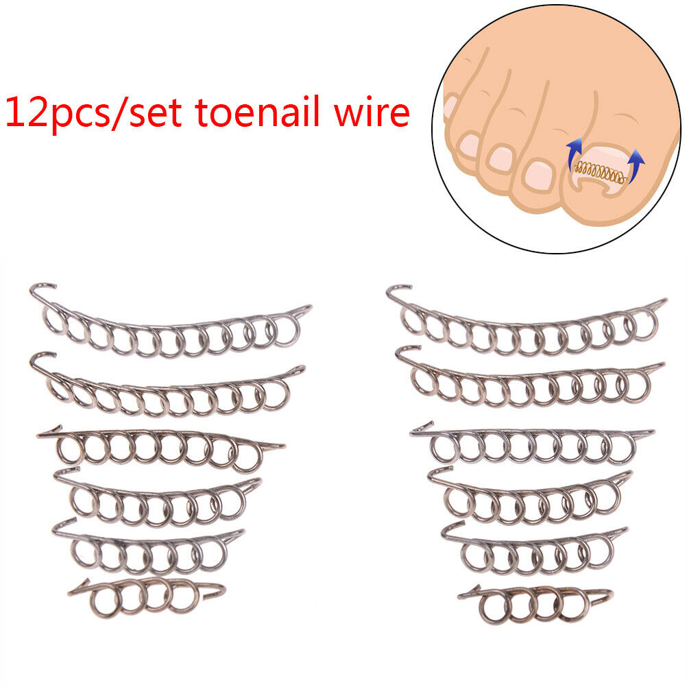 12pcs toenail correction tool ingrown wire fixer toe nail recover foot  TwY1