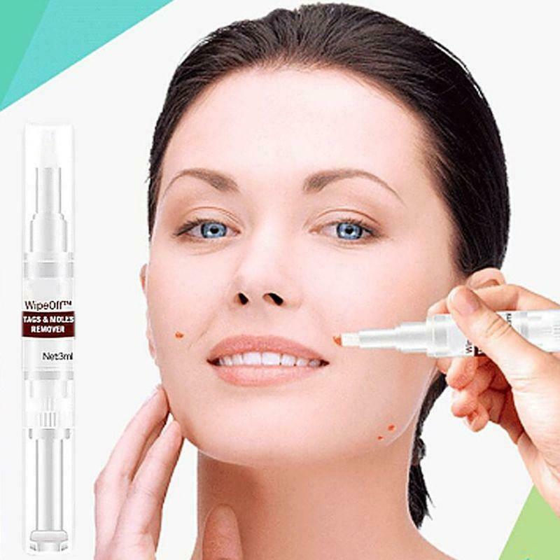 10ml Skin Tags Moles Remover Pen Facial Body Wart Dark Spot Treatment Liquid
