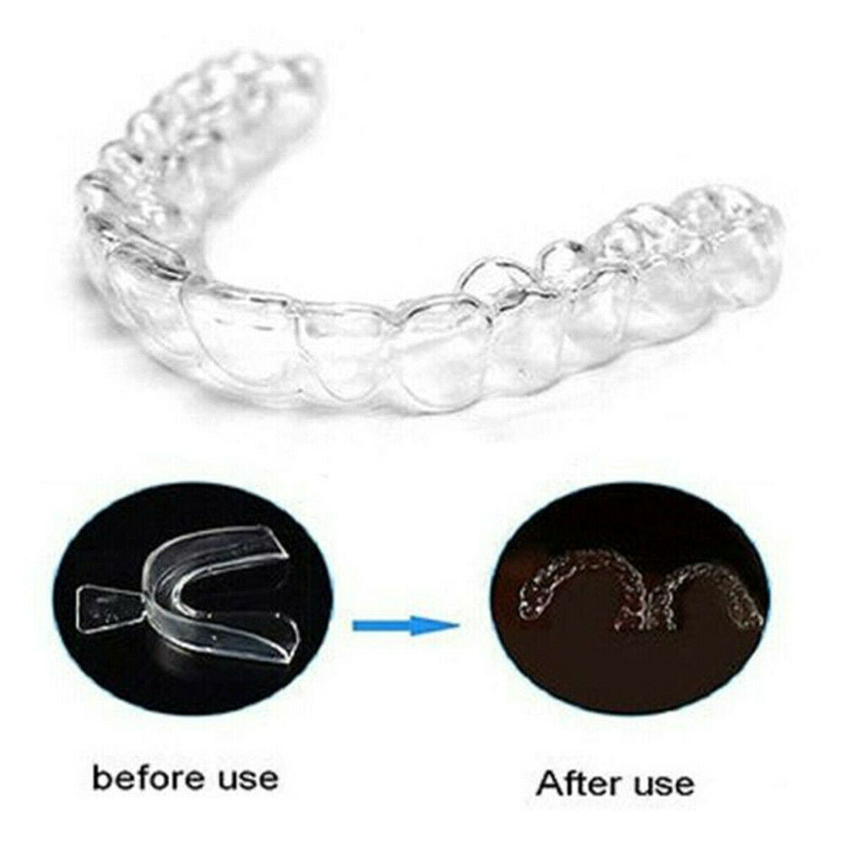 4 x Teeth Whitening Mouth Trays Guard Shields Gum Moulds Remouldable Bleaching