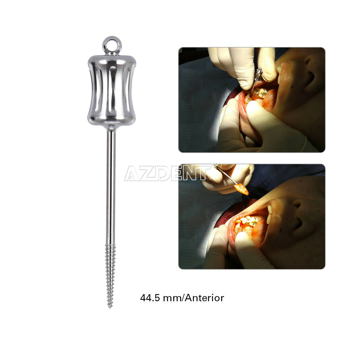 2Pc Dental Extractor Rotate Apical Root Fragments Drill Long+Short 34.3mm-44.5mm