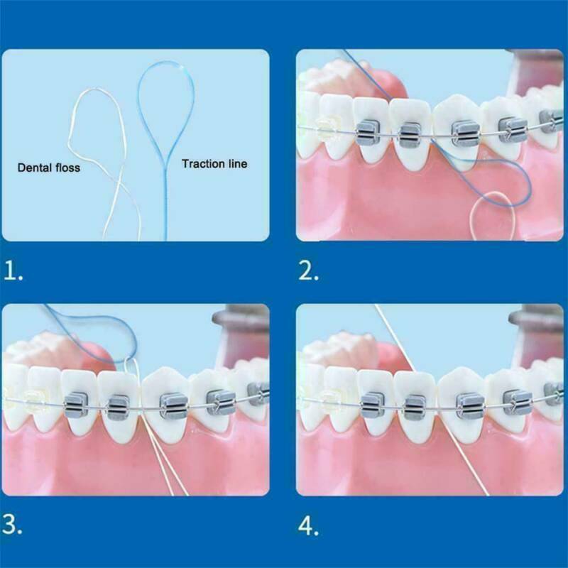 105x Nylon Dental Floss Threaders Simple Loop + Case For Braces Bridges Implants
