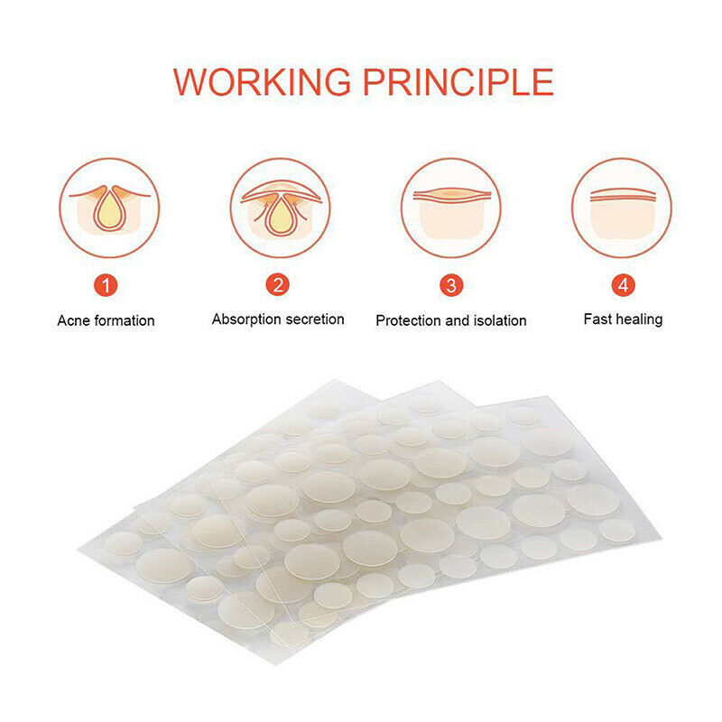 36pcs Acne Pimple Patch Acne Removal Stickers Blemish Treatment Face Skin.l8