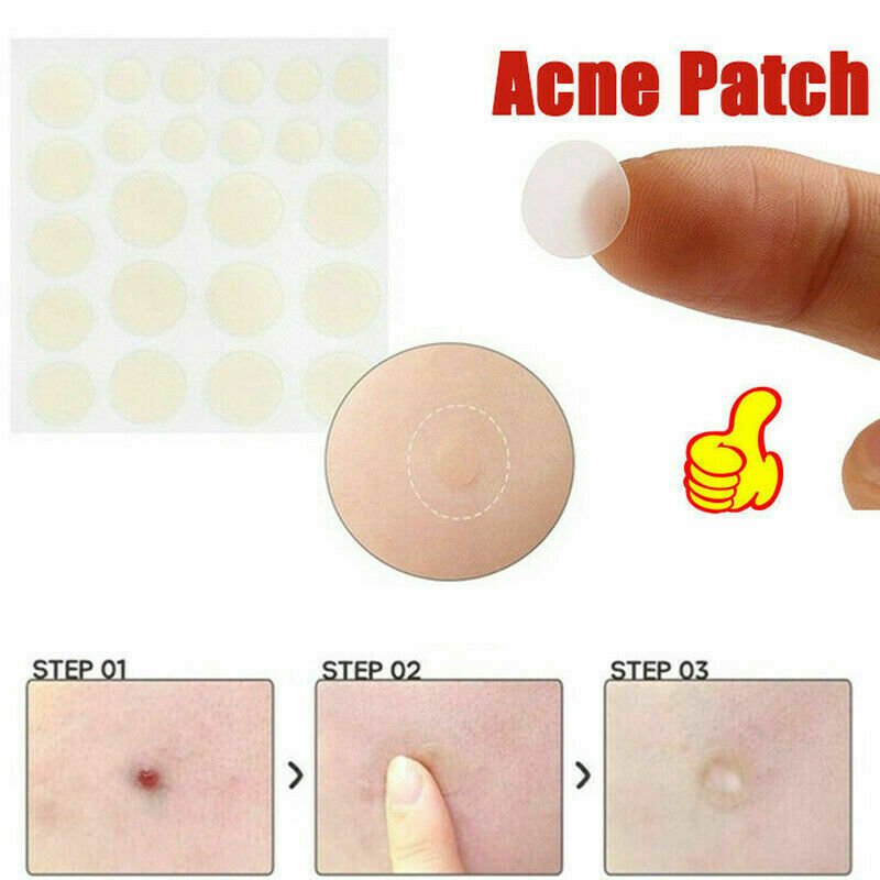 72Pcs Dermopatchy Acne & Skin Tags Pimple Remover Patch Removal Facial Care