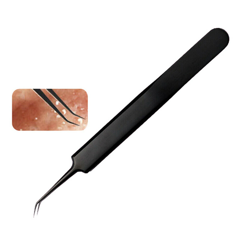 11pcs Professional Acne Removal Tools Kit Blackhead Extractor Face Care @