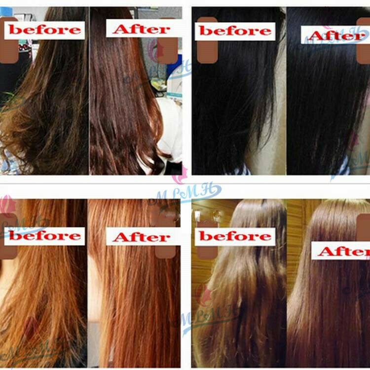 30ML Lanthome Herbal Fast Hair Growth Essence Liquid Anti Loss Treatment Sprayer