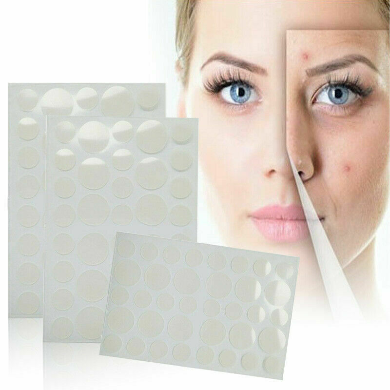 36 Patches Anti Acne Pimple Patch Face Skin Spot Scar Care Treatment Stickers ..