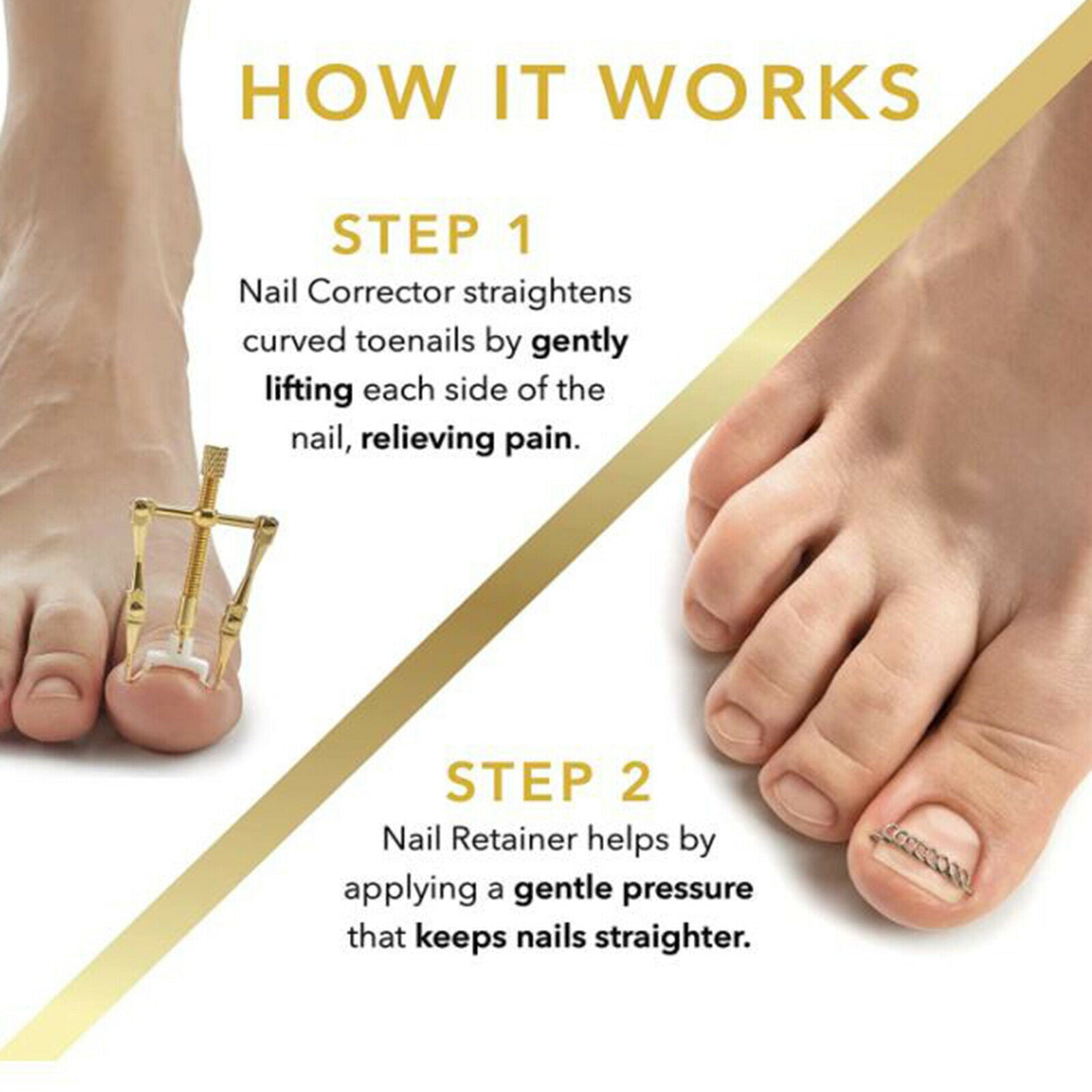 Portable Ingrown Toenail Correction Nail Lifter Clamp Foot Pedicure Tool
