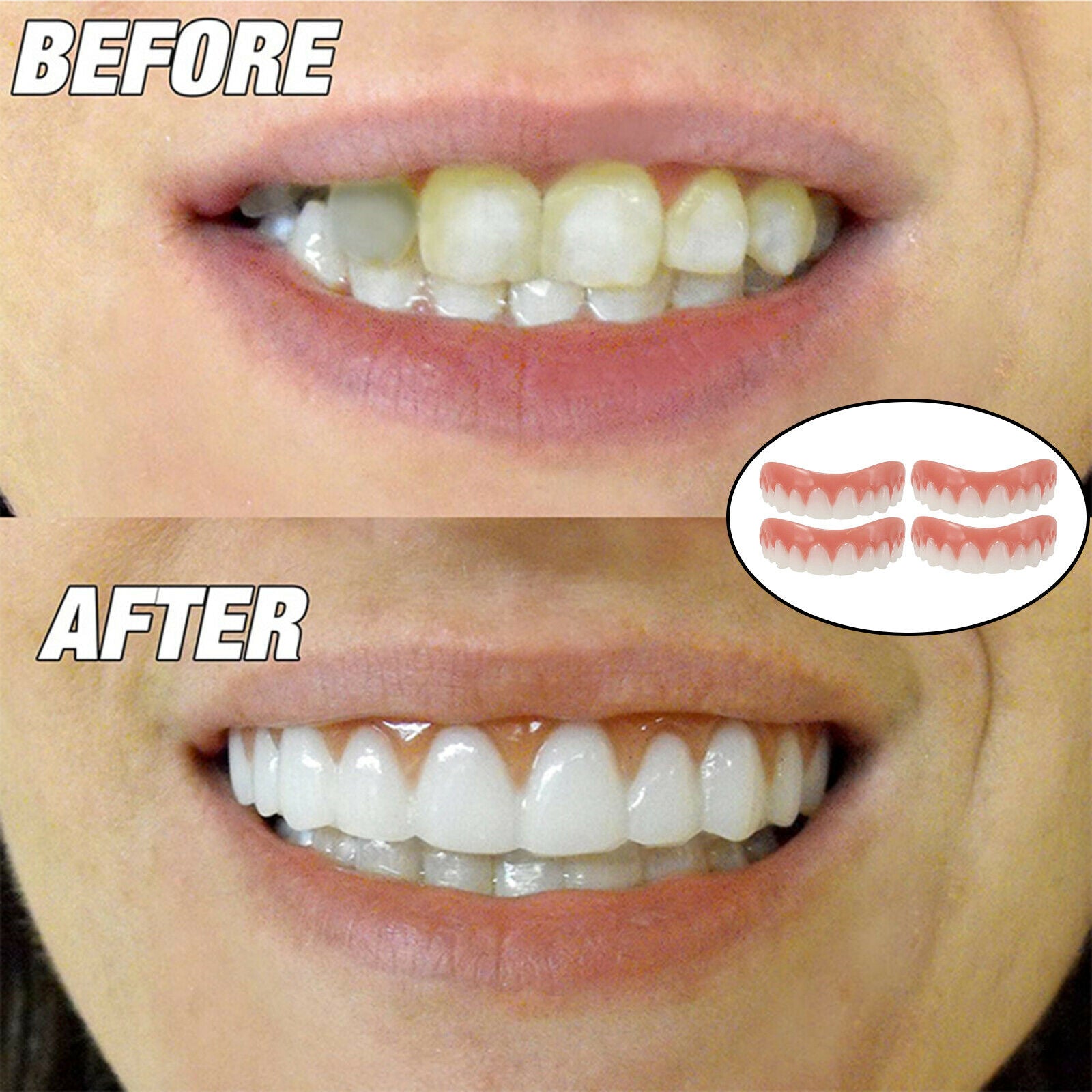 Smiling Braces Top False Teeth Veneers Tooth Covering Simulation