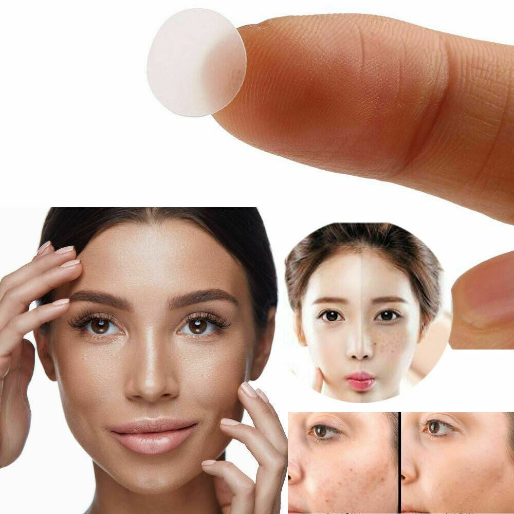 36X Skin Tag & Acne Patch Hydrocolloid Acne & Skin Tag Invisible Remover Patches