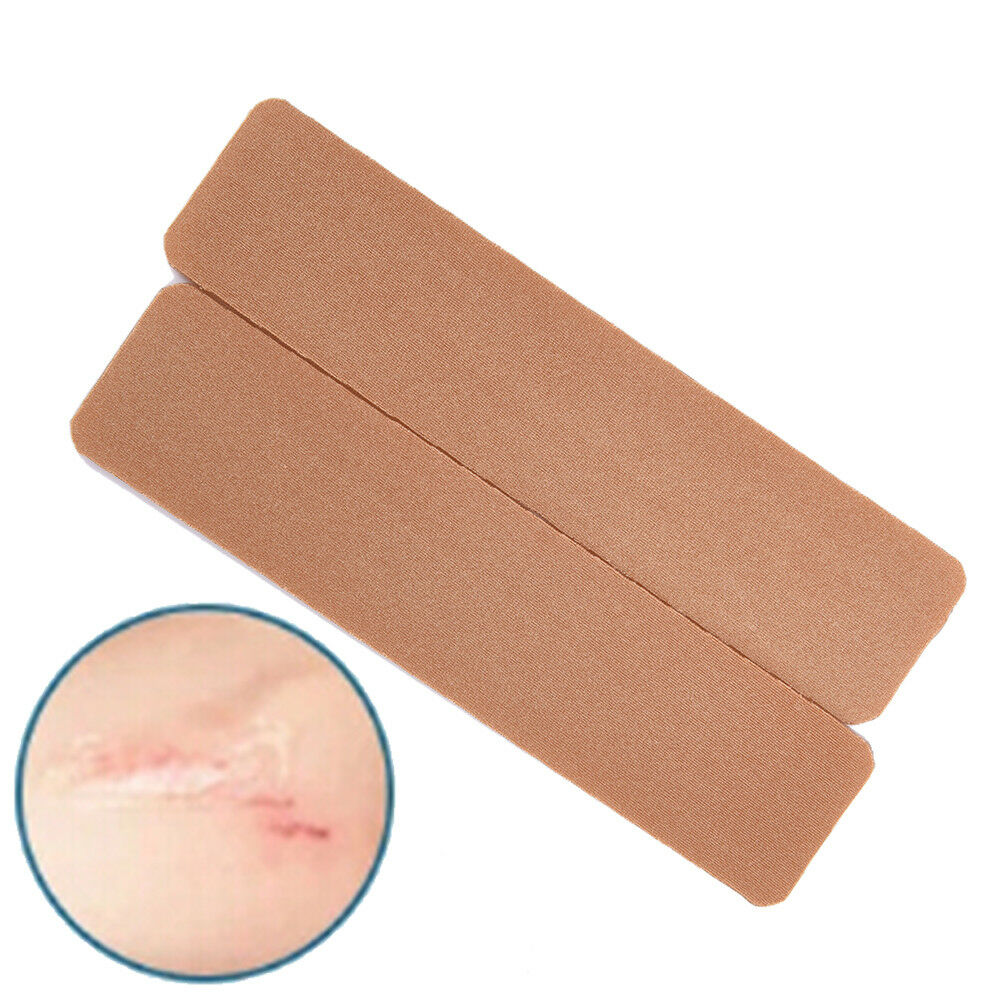 2X Scars Wounds Silicone Scar Gel Away Strips Remover Treatment Patch Therap BDD
