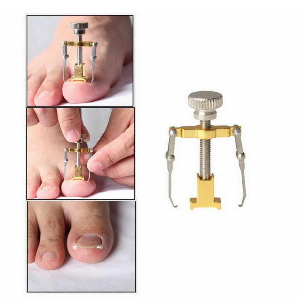 2pcs Ingrown Toe Nail Correction Fixer Straightener Clippers Tools
