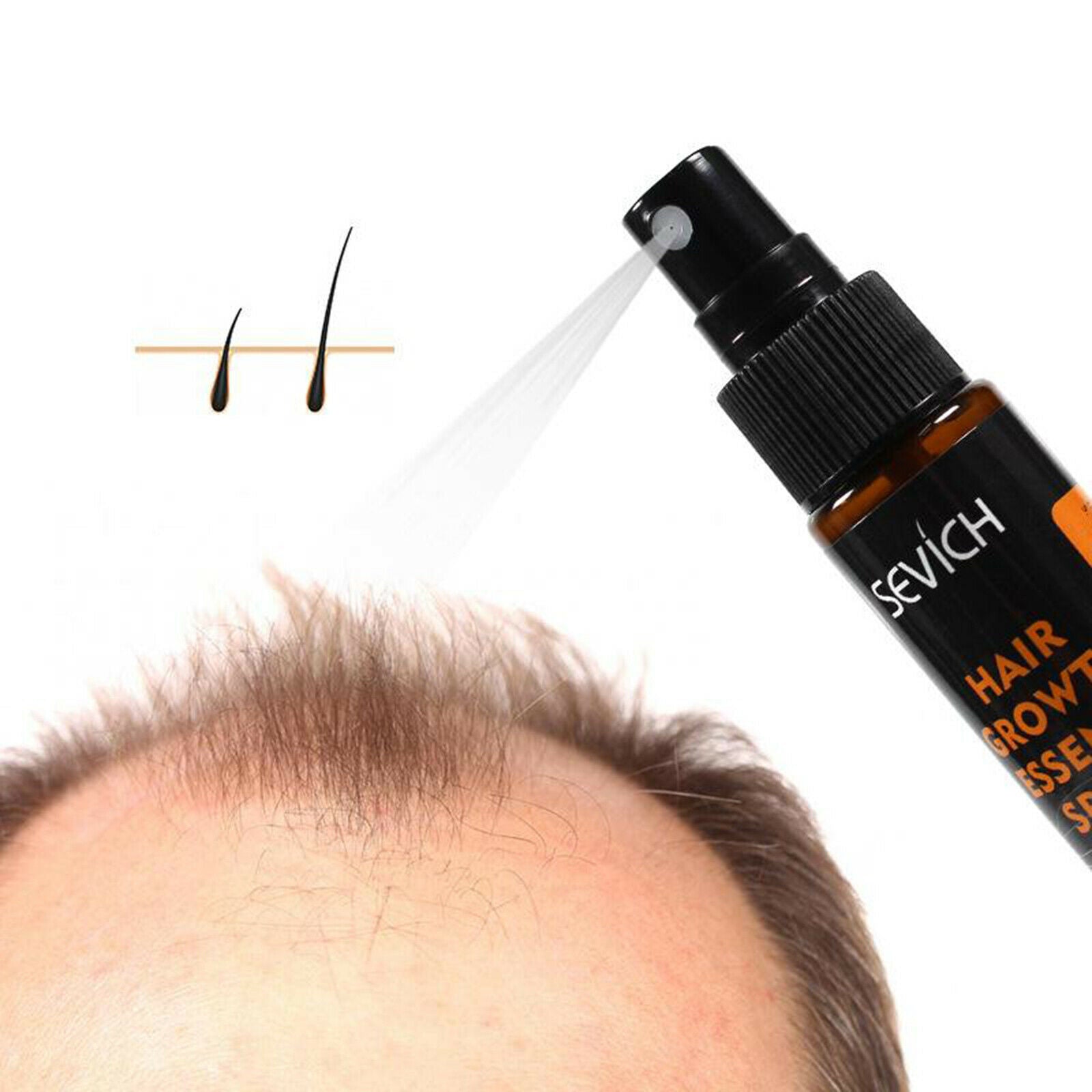 Hair Growth Spray to Help Grow Healthy, Strong Hair Suitable for Men and Women