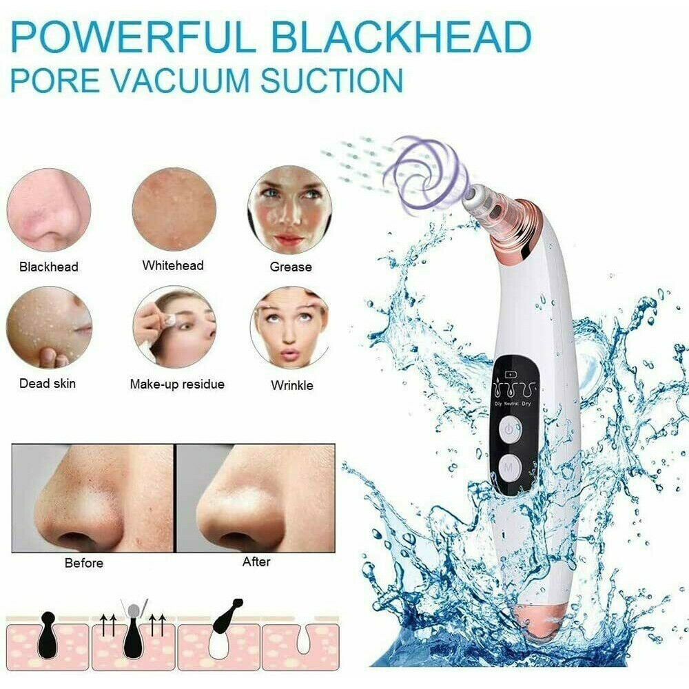 Visible Electric Blackhead Remover with Camera Derma Vacuum Pore Cleaner Suction