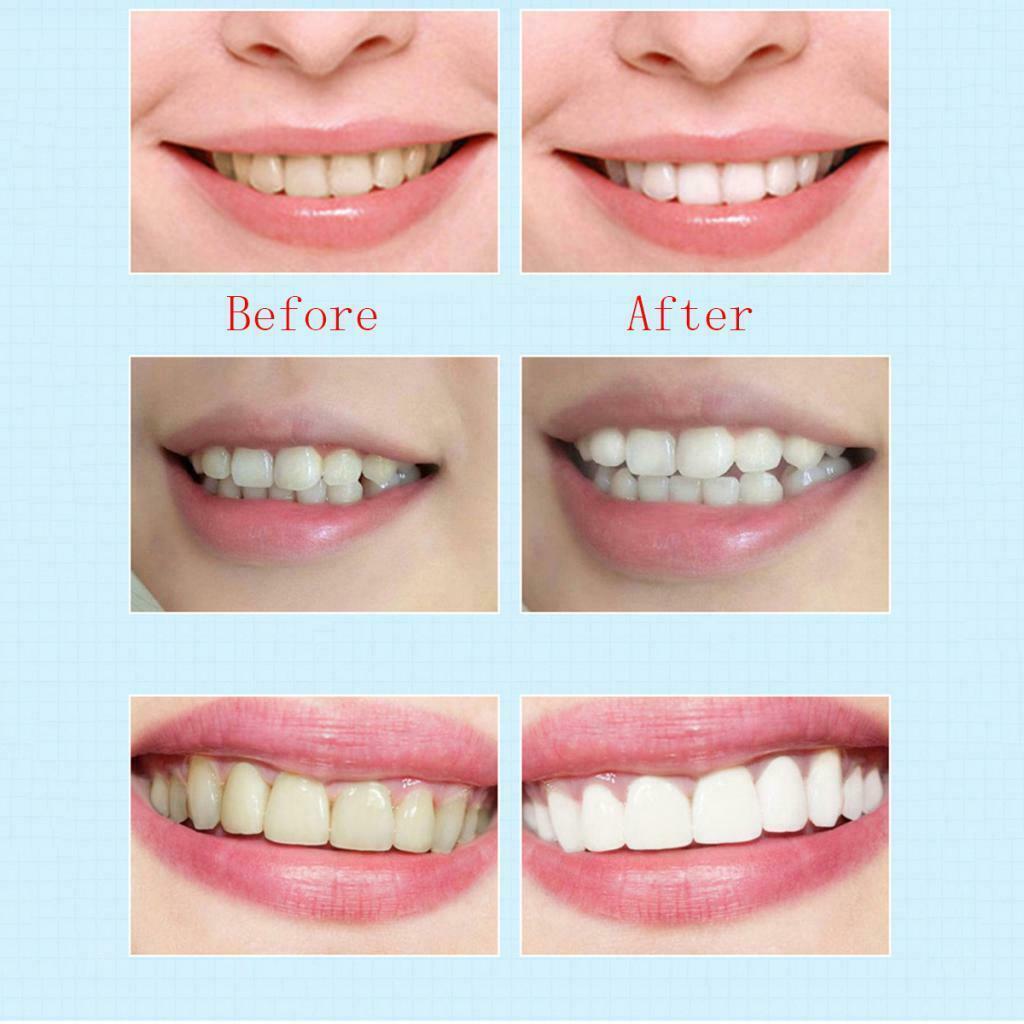 Teeth Whitening Pen Whitener Cleaning Bleaching Stains Remover Oral Care