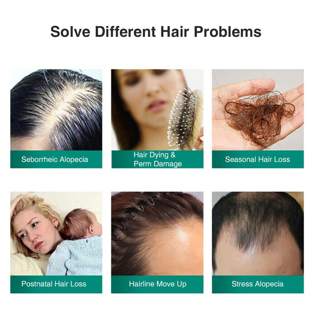Ginger Hair Growth Essential Spray Anti Hair Loss Serum 7 Days Effective 30ml