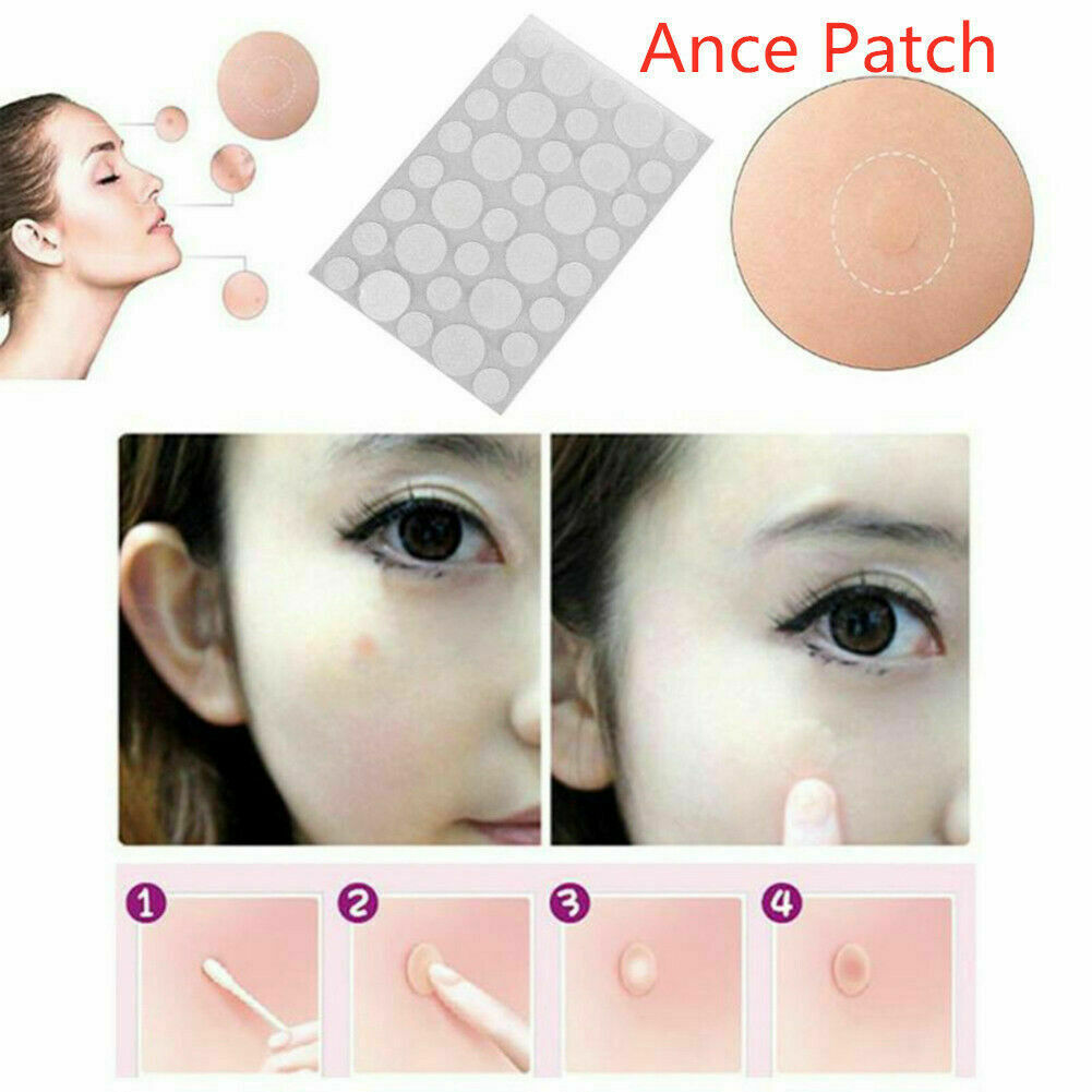 36Pcs Remover Patch Stickers Acne Set Pimple Master Treatment Skin Care Tools