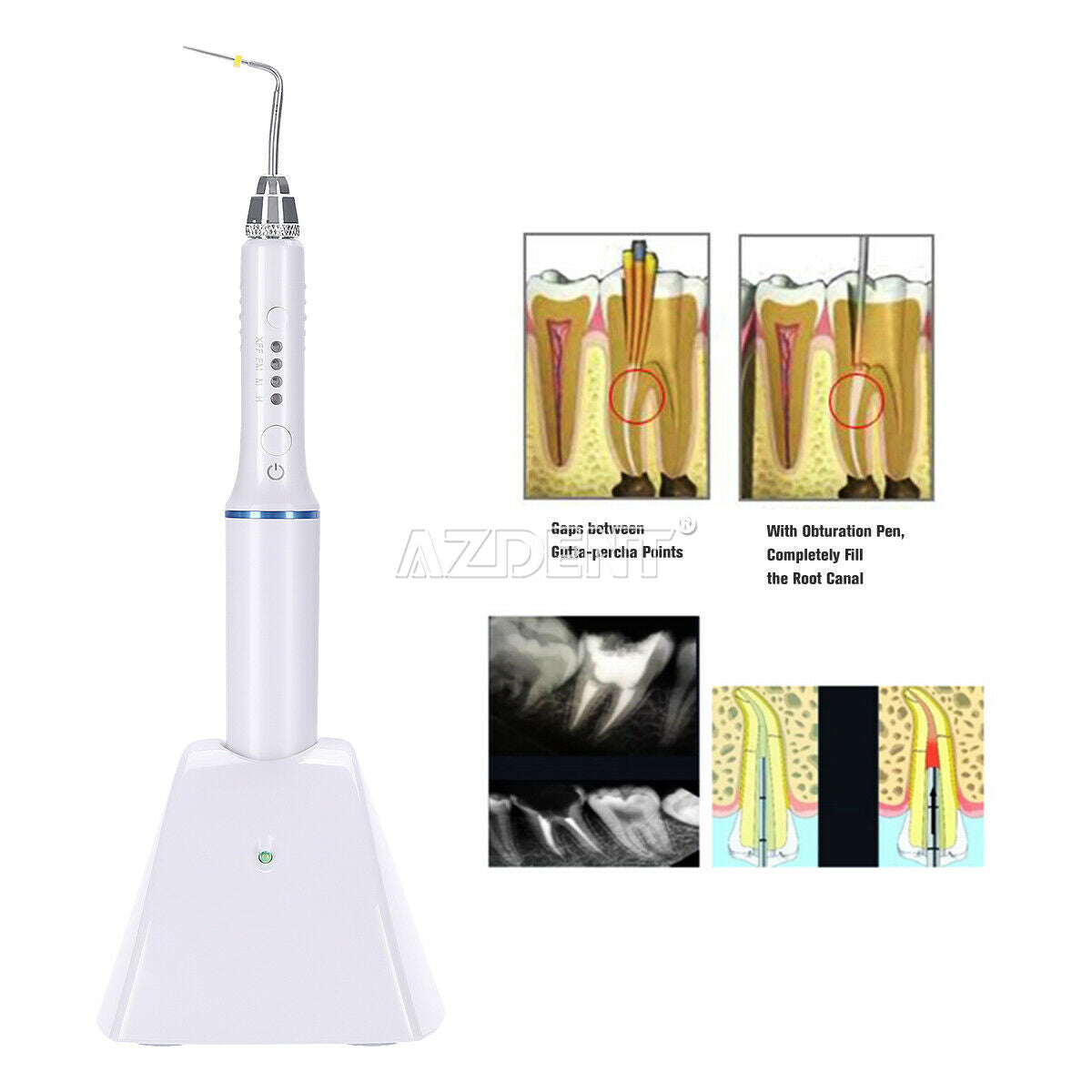 Cordless Dental Endo Obturation Pen Gutta Percha Endodontic Pen 4Pc Tips J1SS
