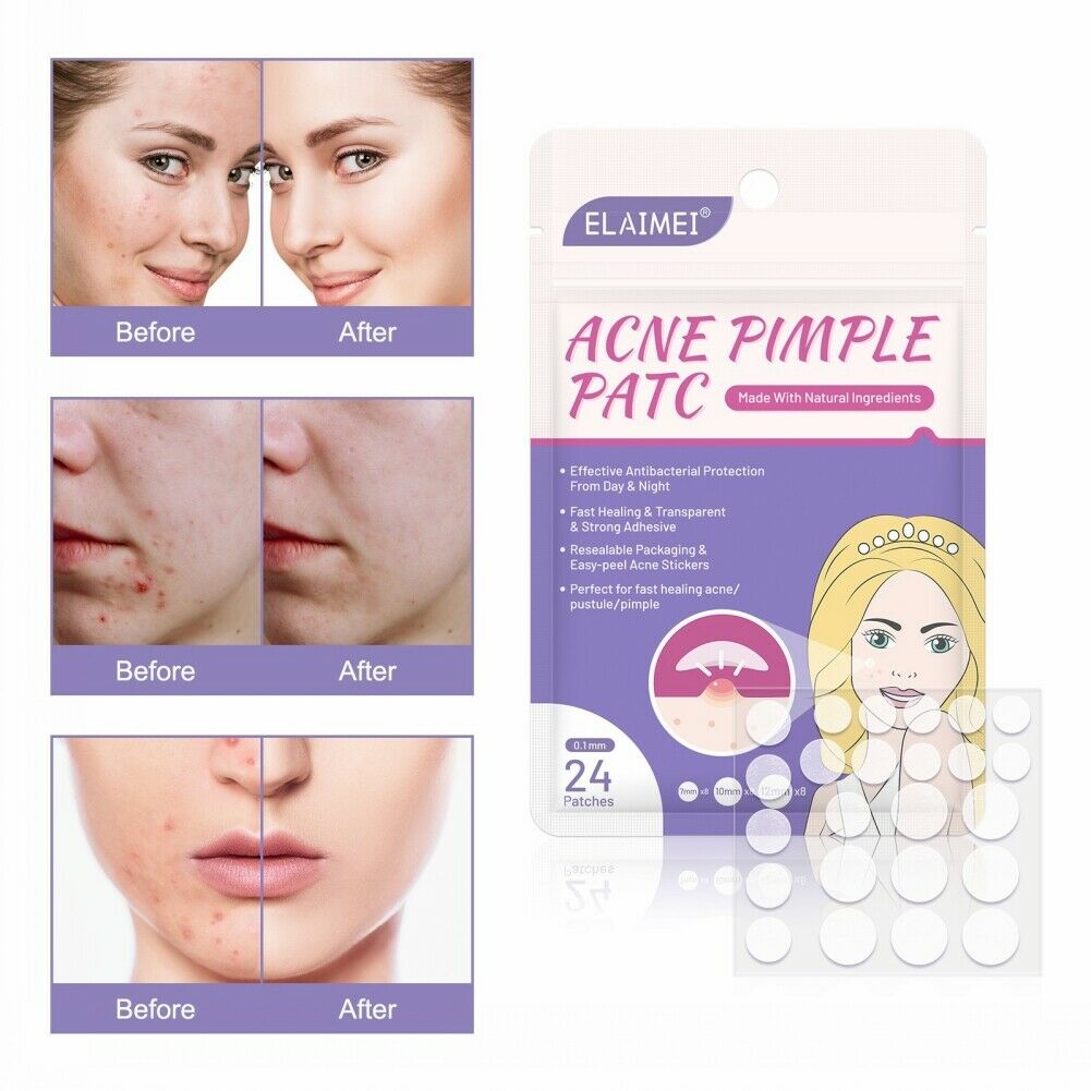 24Pcs/Sheet Invisible Acne Patches Anti-Acne Colloidal Acne-Covering Patch