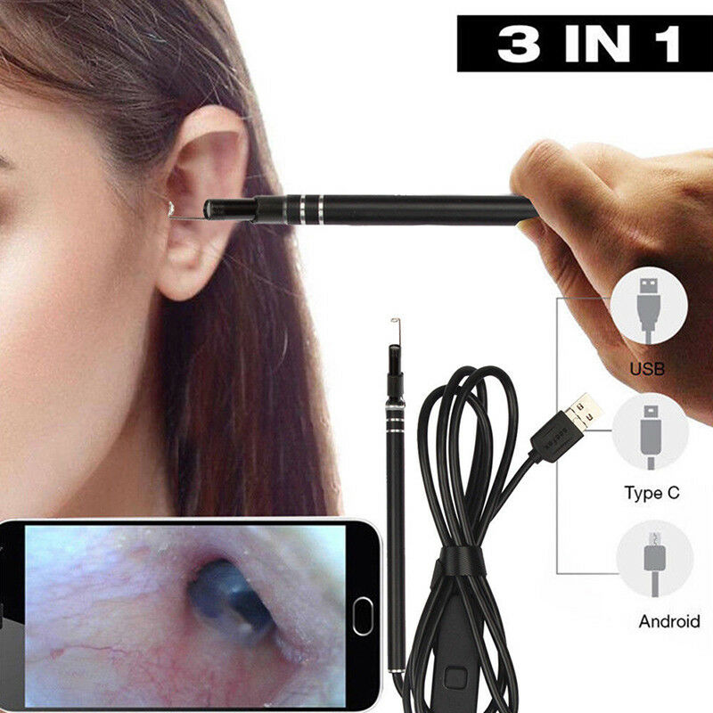 Digital Led Otoscope Ear CameraScope Earwax Removal Kit Ear Wax Cleaning TooY^WF