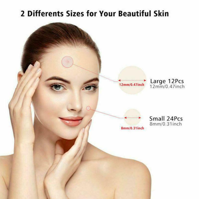 acne Pimple Patch, Hydrocolloid Acne Healing Patches, Invisible Absorbing Cover